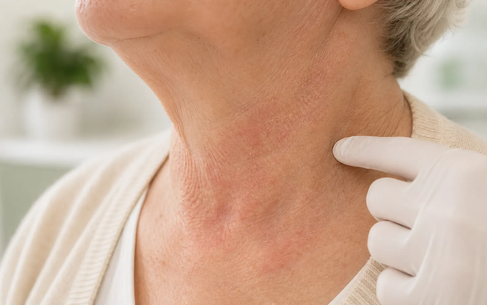 Allgemeine Dermato­logie
